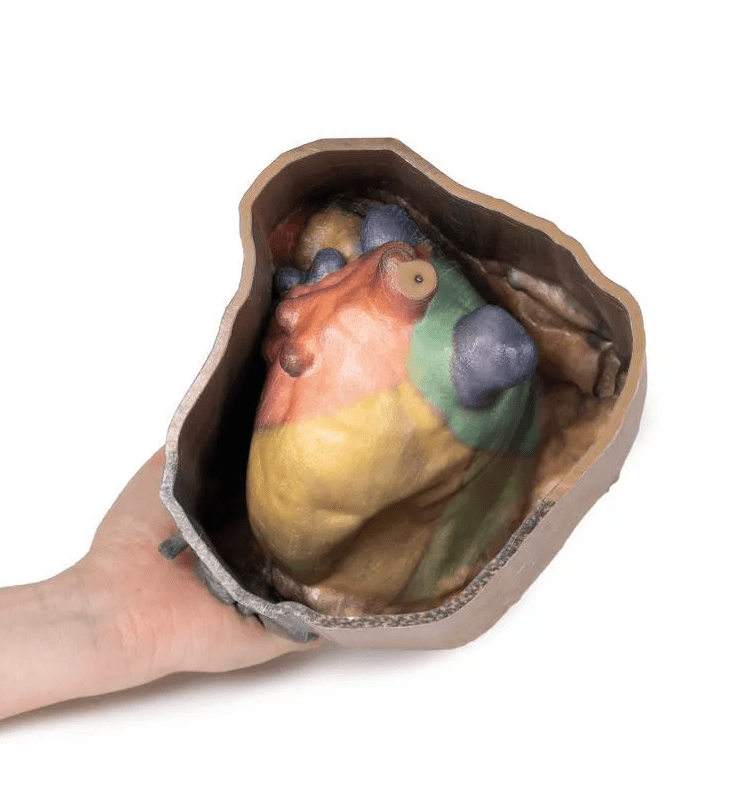 Perikardraum - Modell - Erler - Zimmer